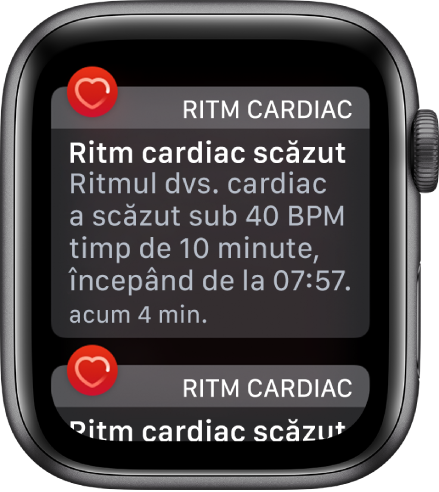 Un ecran Alertă de ritm cardiac, indicând faptul că a fost detectat un ritm cardiac scăzut.