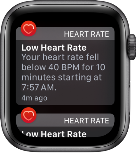 Zaslon funkcije Heart Rate Alert (Opozorilo o srčnem utripu), ki prikazuje zaznavo nizkega srčnega utripa.
