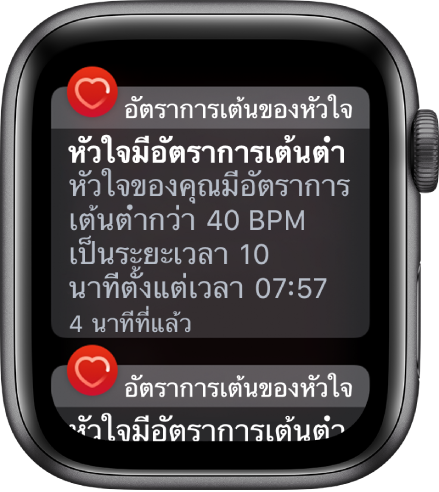 หน้าจอแจ้งเตือนอัตราการเต้นของหัวใจระบุว่ามีการตรวจพบอัตราการเต้นของหัวใจที่ตํ่า