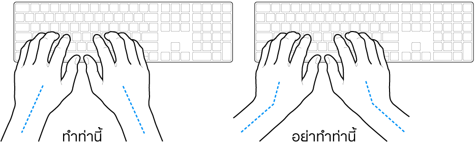 มือวางอยู่เหรือแป้นพิมพ์ แสดงตำแหน่งการวางข้อมือและแขนที่ถูกต้องและไม่ถูกต้อง