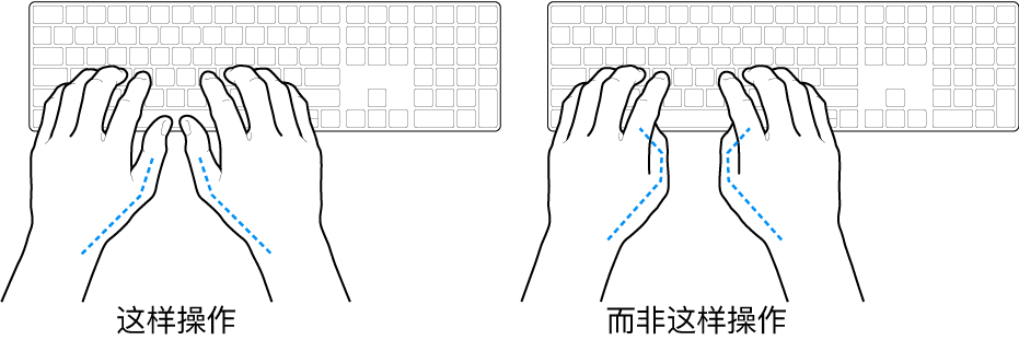 手掌放在键盘上方，显示拇指的正确放置和错误放置。