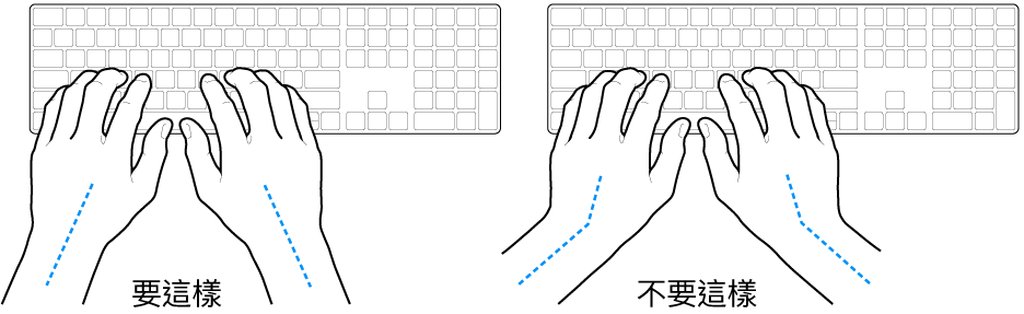 雙手置於鍵盤上，分別顯示正確與不正確的手肘與雙手對稱擺放位置。