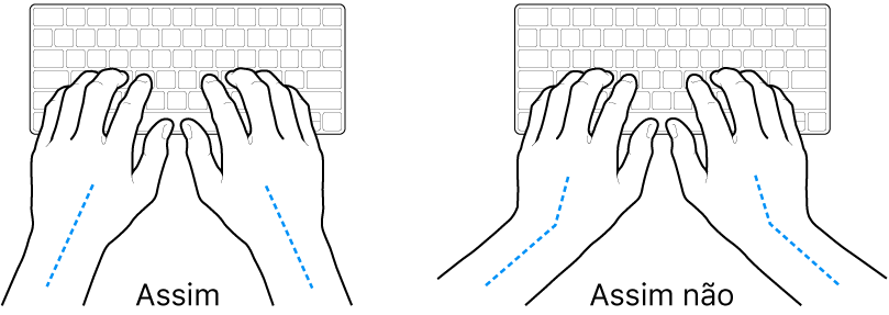 As mãos posicionadas sobre um teclado a mostrar alinhamentos corretos e incorretos das mãos e dos pulsos.