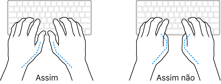 As mãos posicionadas sobre um teclado a mostrar a colocação correta e incorreta dos polegares.