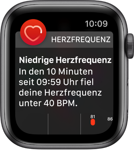 Ein Warnbildschirm mit dem Hinweis, dass eine zu niedrige Herzfrequenz festgestellt wurde.