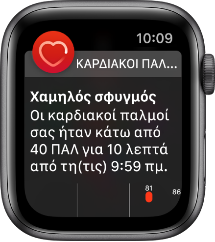 Οθόνη ειδοποίησης Καρδιακών παλμών που δείχνει ότι ανιχνεύτηκε χαμηλός σφυγμός.