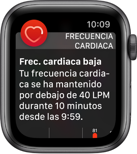 Una pantalla de aviso de frecuencia cardiaca que indica que se ha detectado una frecuencia cardiaca baja.