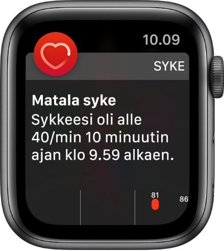 Syke-hälytyksen näyttö, joka ilmoittaa, että matala syke on havaittu.