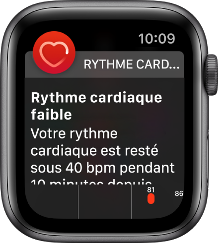 L’écran Alerte de Rythme cardiaque qui indique la détection d’un rythme cardiaque faible.