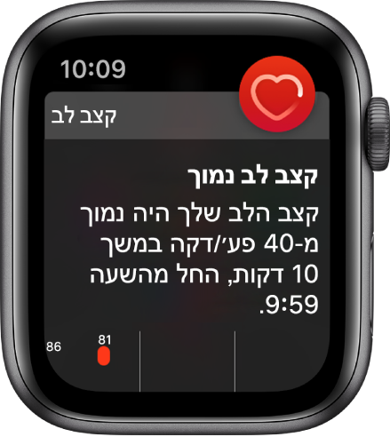 מסך התראת דופק מורה על זיהוי דופק נמוך.