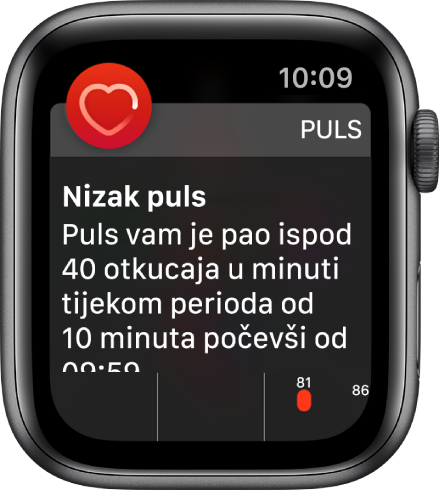 Zaslon s Obavijesti za puls koji prikazuje da je detektiran sniženi puls.