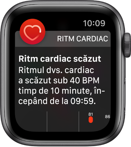 Un ecran Alertă de ritm cardiac, indicând faptul că a fost detectat un ritm cardiac scăzut.