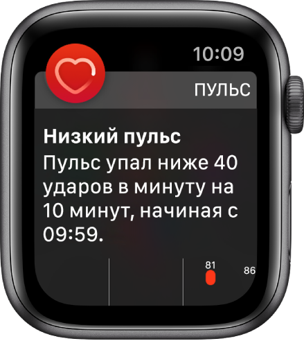 Экран оповещения о пульсе, где указано, что пульс слишком низкий.