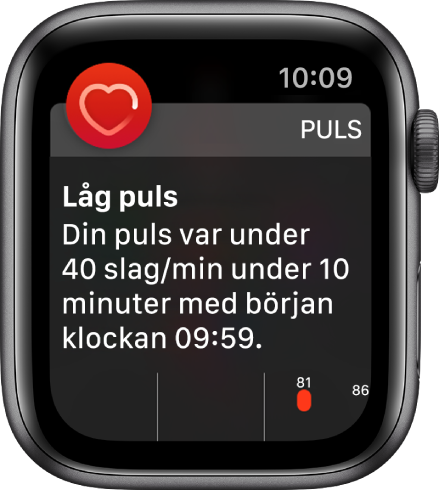 En skärm med en pulsvarning som visar att en låg puls har upptäckts.
