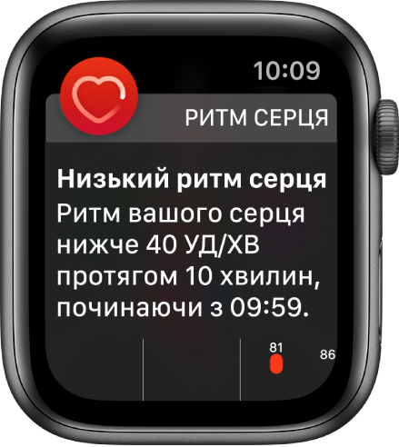 Екран оповіщення про ритм серця з повідомленням про низький ритм серця.