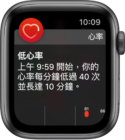 「心率提示」畫面表示偵測到過低的心率。