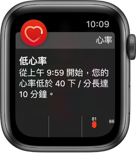 「心率提示」畫面表示偵測到過低的心率。
