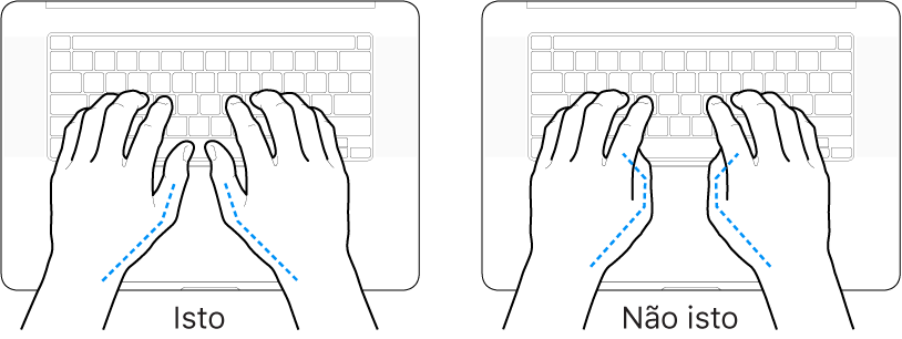 Mãos posicionadas sobre um teclado, mostrando os alinhamentos correto e incorreto dos polegares.