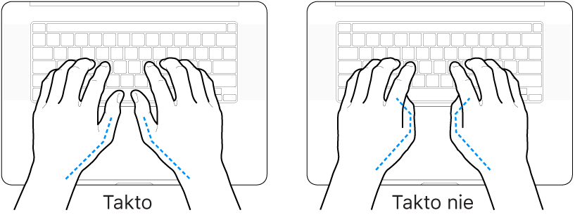 Ruky položené na klávesnici znázorňujúce správnu a nesprávnu polohu palcov.