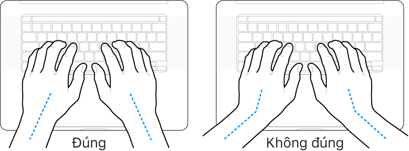 Các bàn tay đặt phía trên bàn phím, minh họa cách đặt cổ tay và bàn tay đúng và sai.