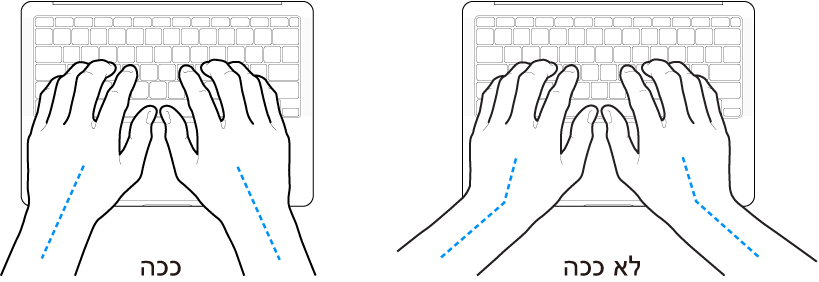ידיים מעל מקלדת, להדגמת מנח נכון ומנח שגוי של כף היד ושורש כף היד.