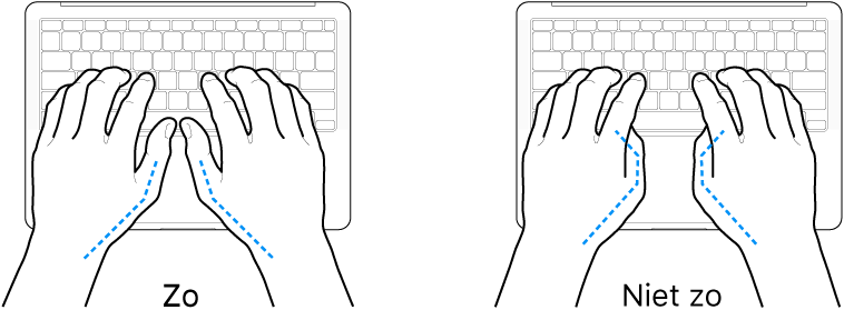 Handen boven een toetsenbord, waarbij de goede en verkeerde stand van de duimen wordt aangegeven.
