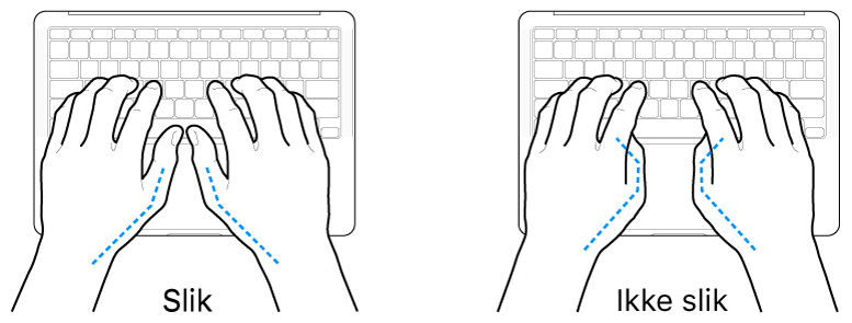 Hender plassert over et tastatur som viser riktig og feil tommelstilling.