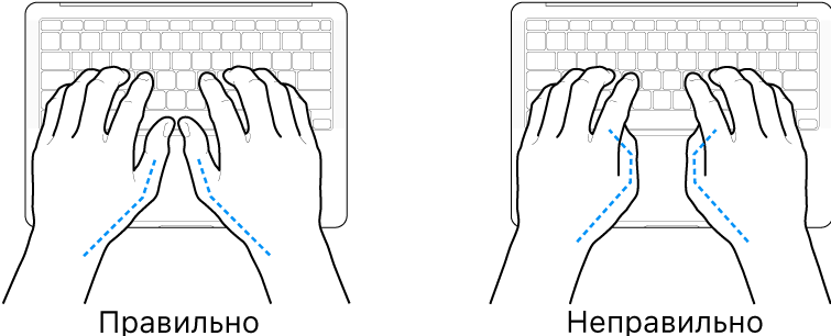 Руки над клавиатурой. Показано правильное и неправильное положение большого пальца.