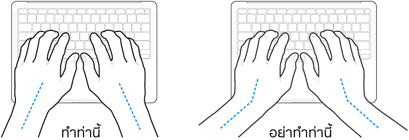 มือวางอยู่เหรือแป้นพิมพ์ แสดงตำแหน่งการวางข้อมือและแขนที่ถูกต้องและไม่ถูกต้อง