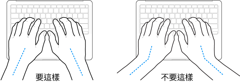 雙手置於鍵盤上，分別顯示正確與不正確的手肘與雙手對稱擺放位置。