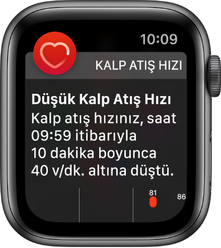 Düşük kalp atış hızı algılandığını gösteren Kalp Atış Hızı Uyarı ekranı.