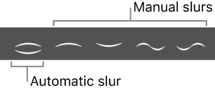 Figure. Part box showing automatic and manual slurs.
