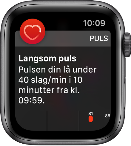 En pulsvarsel-skjerm som viser at langsom puls er registrert.