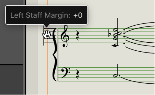 Figure. Layout tool over left margin of staff system.