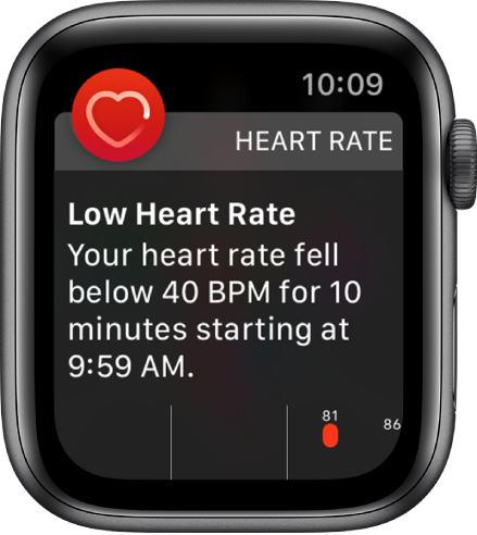 Екран Heart Rate Alert (Предупреждение за сърдечен пулс), показващ, че е на лице слаб сърдечен пулс.