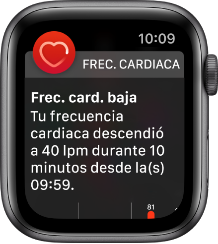 Pantalla "Alerta de frecuencia cardiaca" indicando que se detectó una frecuencia cardiaca baja.