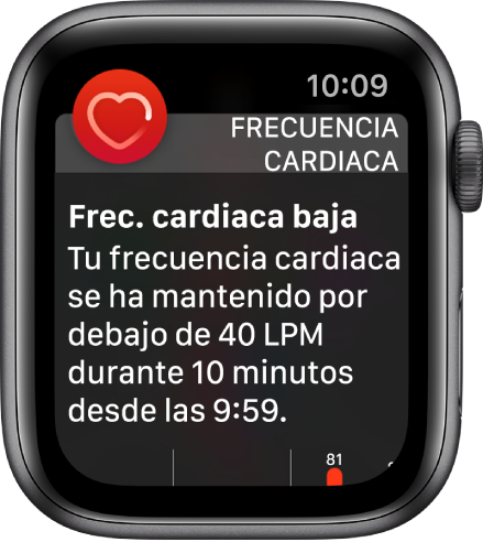 Una pantalla de aviso de frecuencia cardiaca que indica que se ha detectado una frecuencia cardiaca baja.