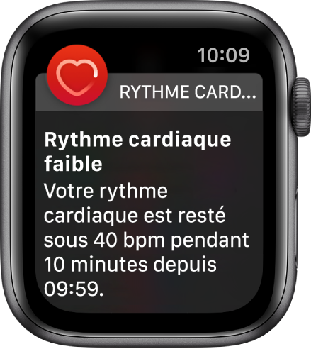 L’écran Alerte de Rythme cardiaque qui indique la détection d’un rythme cardiaque faible.