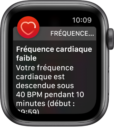 Un écran d’alerte de fréquence cardiaque indiquant qu’une fréquence cardiaque faible a été détectée.