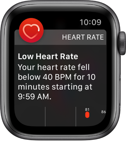 Ekrāns Heart Rate Alert, kas norāda, ka ir konstatēts lēns pulss.