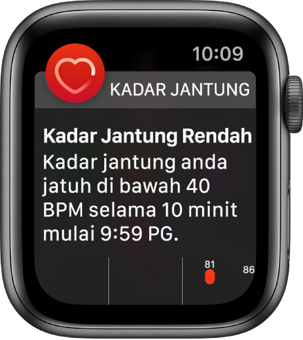 Skrin Isyarat Kadar Jantung menunjukkan kadar jantung rendah dikesan.