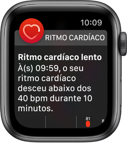 Um aviso de ritmo cardíaco a indicar que foi detetado um ritmo cardíaco lento.