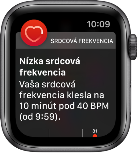 Obrazovka Upozornenie o srdcovej frekvencii označuje zistenie nízkej srdcovej frekvencie.