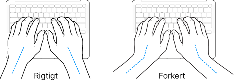 Hænder anbragt over et tastatur med rigtig og forkert position af håndled og hånd.