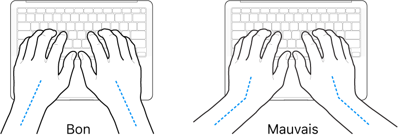 Mains placées sur un clavier, montrant le bon et le mauvais alignement des poignets et des mains.