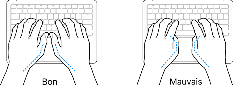 Mains placées sur un clavier, montrant la bonne et la mauvaise position des pouces.