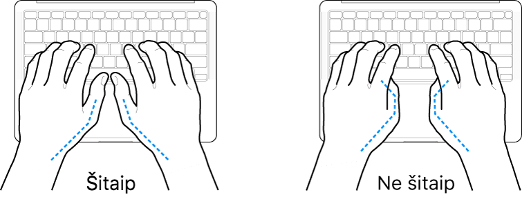 Virš klaviatūros laikomos rankos: rodoma, kaip tinkamai ir netinkamai laikyti nykščius.