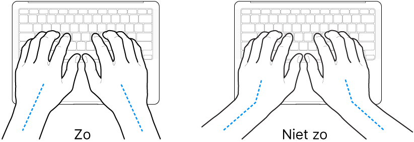 Handen boven een toetsenbord, waarbij de goede en verkeerde stand van de handen en polsen wordt aangegeven.