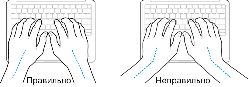 Руки над клавиатурой. Показано правильное и неправильное положения запястья и руки.