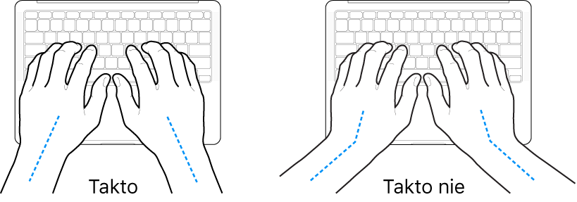 Ruky položené na klávesnici znázorňujúce správnu a nesprávnu polohu zápästia a ruky.